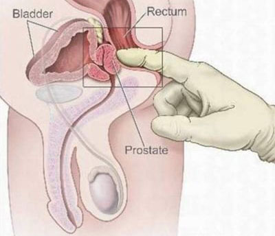 masaje prostata